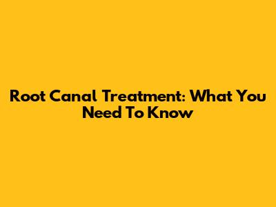 Root Canal Treatment: What You Need To Know